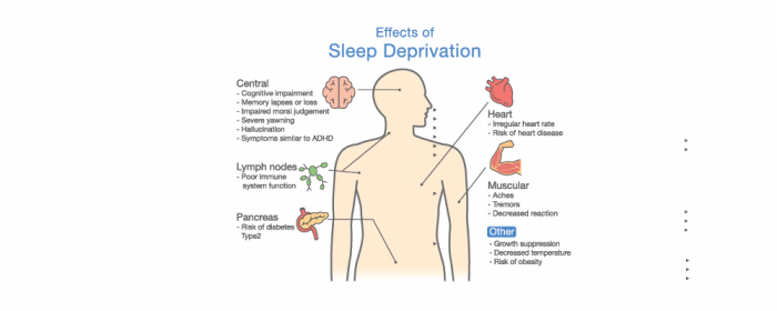 Overworking symptoms